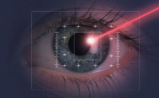 Láser para retinopatía diabética